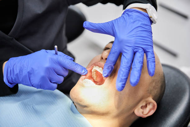 Best Emergency Dentist for Lost Fillings or Crowns in Iva, SC
